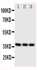CD1A Antibody (aa158-173)