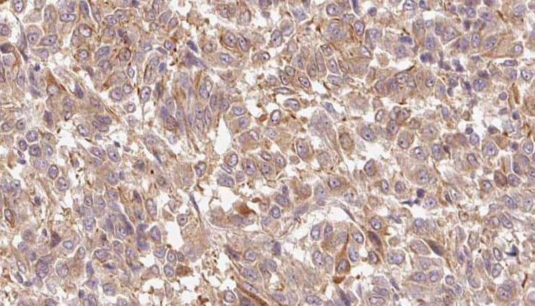S100A7 / Psoriasin Antibody