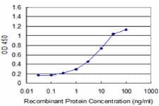 NEUROG1 / NGN1 / Neurogenin 1 Antibody (clone 1F10)