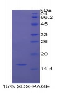 Rat NOS1 / nNOS Protein (Recombinant 6His, N-terminus)