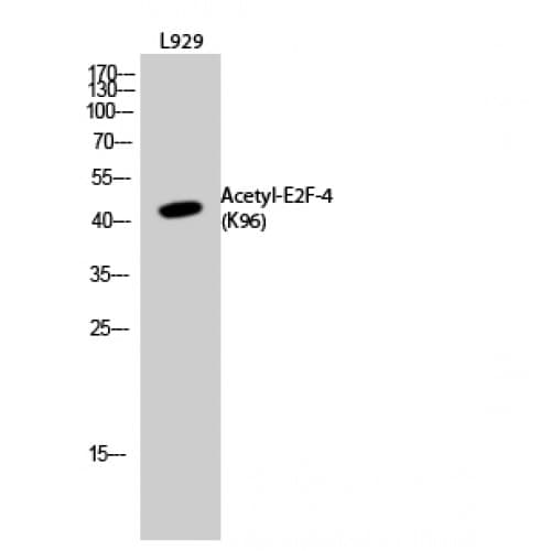 E2F4 Antibody (acetylation site of K96.)