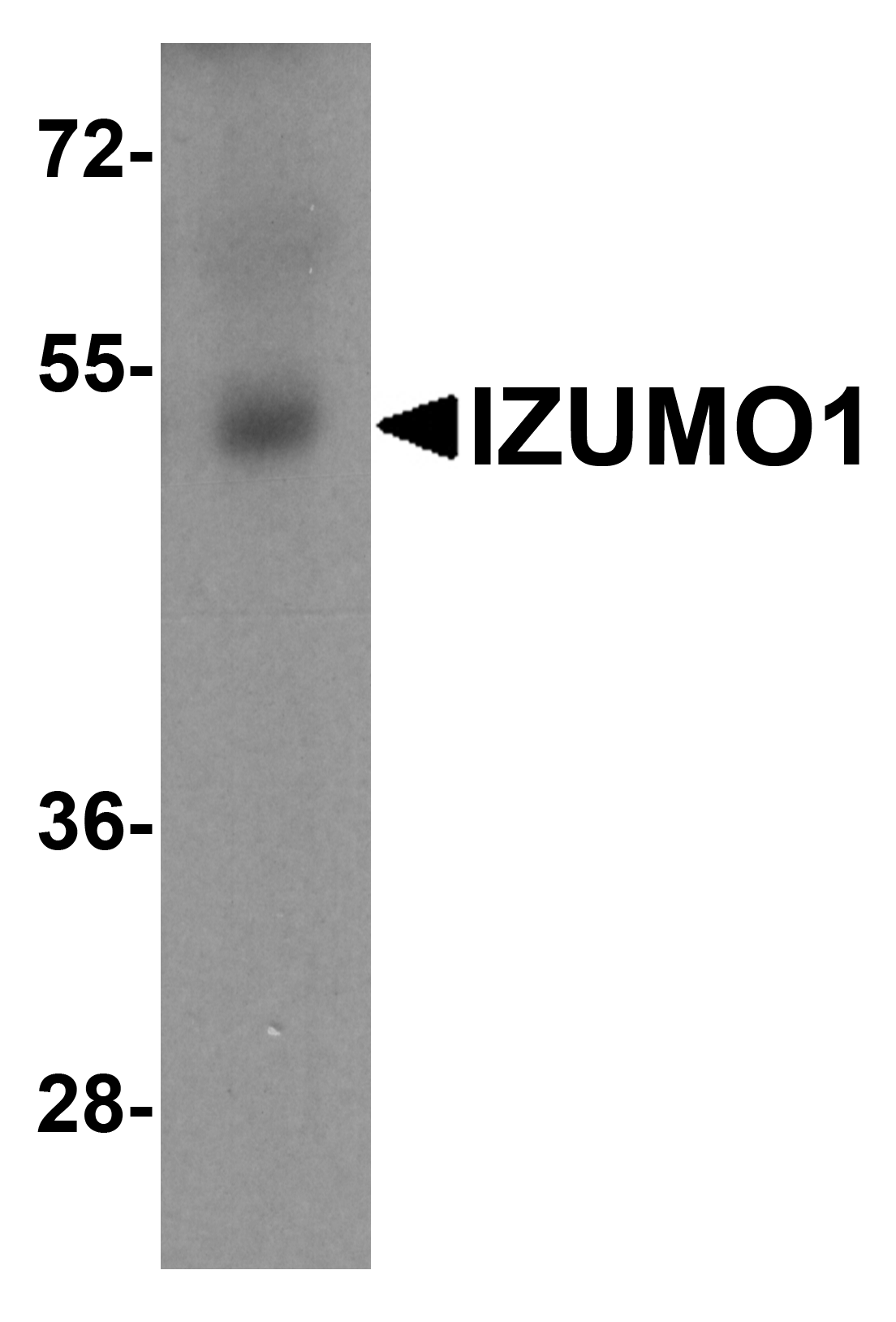 Polyclonal Rabbit anti-Human IZUMO1 / IZUMO Antibody (IHC, WB)