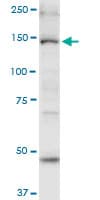 Myosin VI / MYO6 Antibody (clone 2E12)