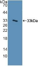 ITGA2 / CD49b Antibody (aa74-277)