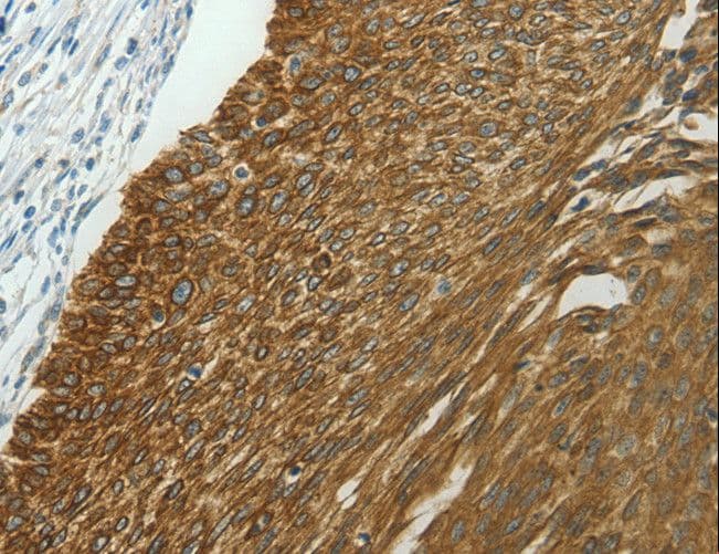 NDRG2 Antibody
