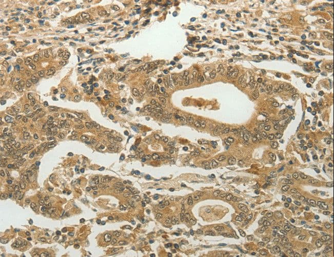 MYSM1 Antibody