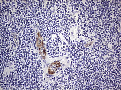 VWF / Von Willebrand Factor Antibody (aa764-1263, clone OTI6C7)