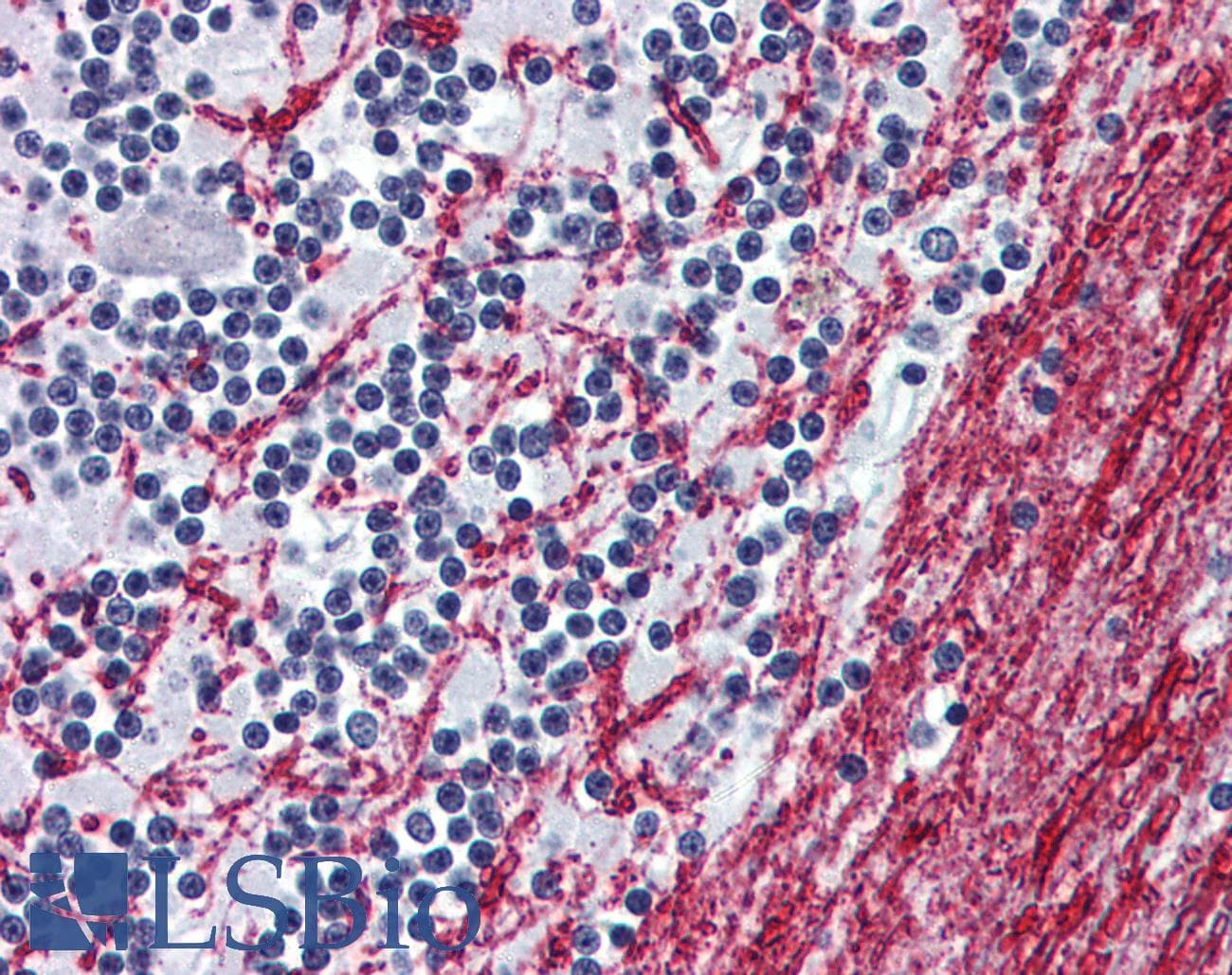 PathPlus™ Polyclonal Rabbit anti-Human OPRM1 / Mu Opioid Receptor Antibody (N-Terminus, IHC)