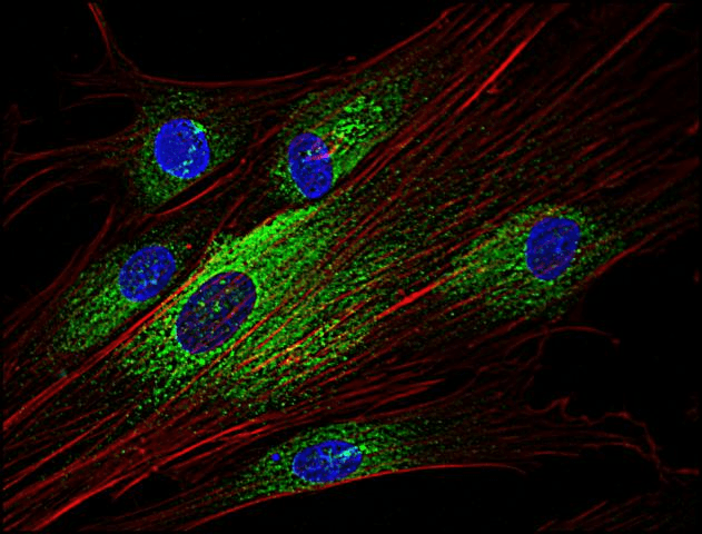 IHC-plus™ SYK Antibody (aa5-360, clone SYK-01)