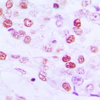 CCNE1 / Cyclin E1 Antibody (Internal)
