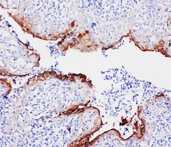 ANXA1 / Annexin A1 Antibody (aa3-24)