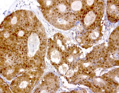 Monoclonal Mouse anti-Human TP / Thymidine Phosphorylase Antibody (clone UMAB90, aa311-482, IHC, WB)