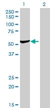 IHC-plus™ Monoclonal Mouse anti-Human DARS Antibody (clone 2F11, IHC, WB)