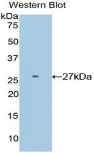 DIXDC1 Antibody (aa513-711)