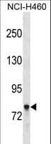 Polyclonal Rabbit anti-Human AMPH / Amphiphysin Antibody (aa140-168, WB)