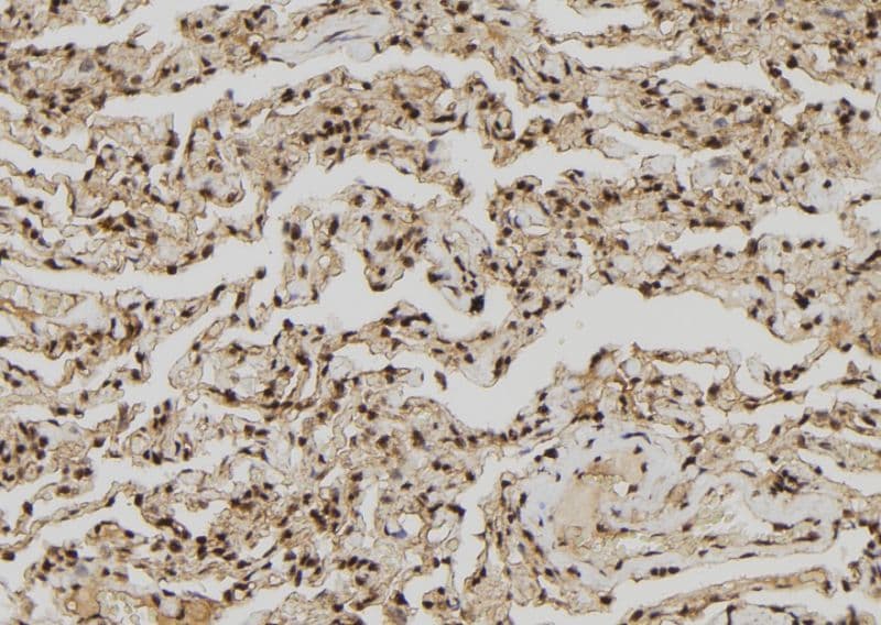 ZNF280A Antibody