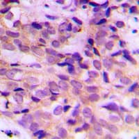 Polyclonal Rabbit anti-Human APG4B / ATG4B Antibody (Internal, IHC, WB)