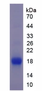 Mouse TNFRSF10B / Killer / DR5 Protein (Recombinant 6His, N-terminus)