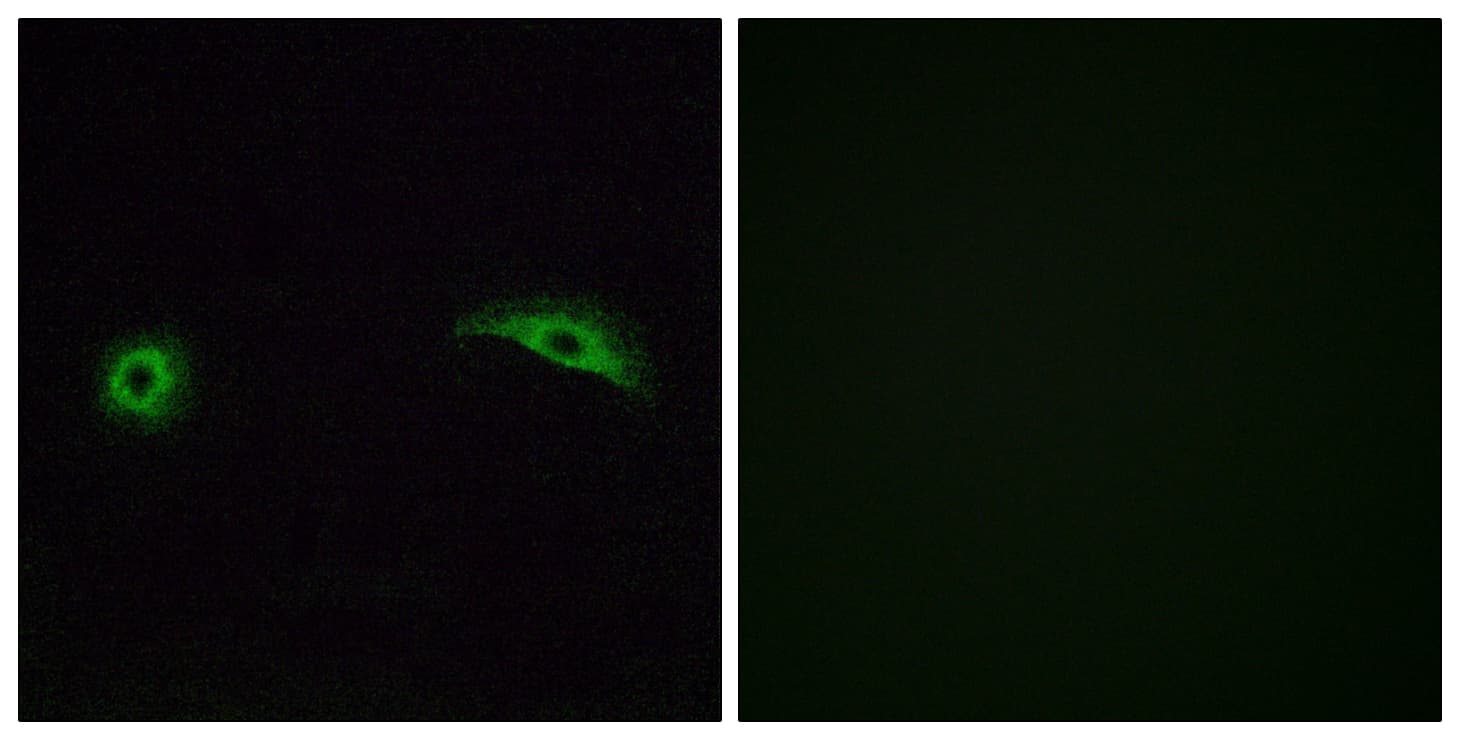 OR2J2 Antibody (aa263-312)