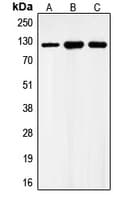 Polyclonal Rabbit anti-Human GABBR1 / GABA B Receptor 1 Antibody (C-Terminus, WB)