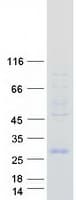 Human HESX1 Protein (Recombinant Myc-DDK (Flag))