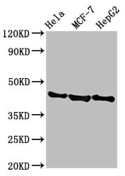 Polyclonal Rabbit anti-Human BFSP2 Antibody (IHC, IF, WB)