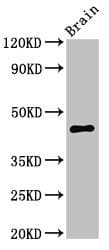 UHMK1 / KIS Antibody