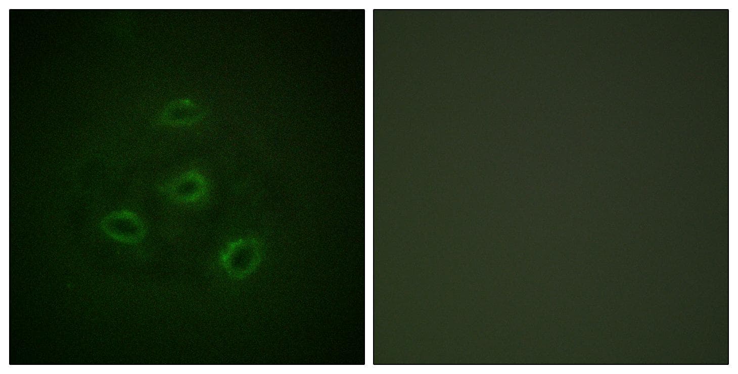 PP2Ac / PPP2CA Antibody (p307)