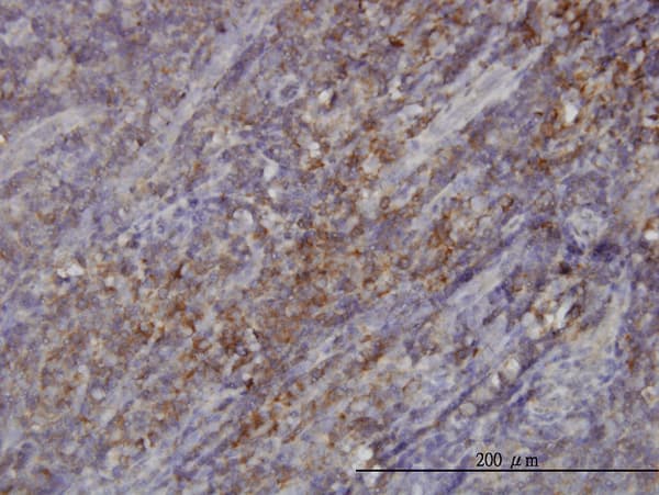 Monoclonal Mouse anti-Human RASGRP4 Antibody (clone 1F3, IHC, WB)