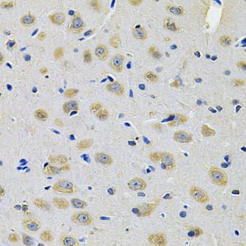 TXNDC5 / ERP46 Antibody