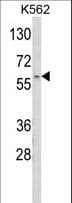 Polyclonal Rabbit anti-Human HSPC167 / CDK5RAP1 Antibody (aa544-571, IHC, WB)