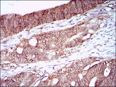 CA9 / Carbonic Anhydrase IX Antibody (aa37-186, clone 7C4A5)