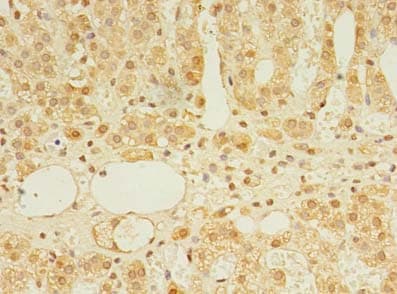 Polyclonal Rabbit anti-Human TRIM15 Antibody (IHC, WB)