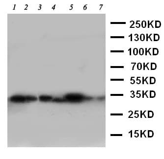 ECI1 / DCI Antibody (aa272-290)