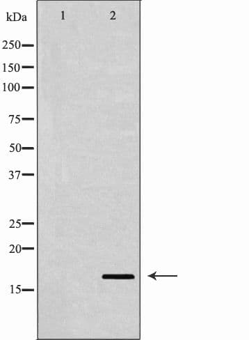 IGF1 Antibody