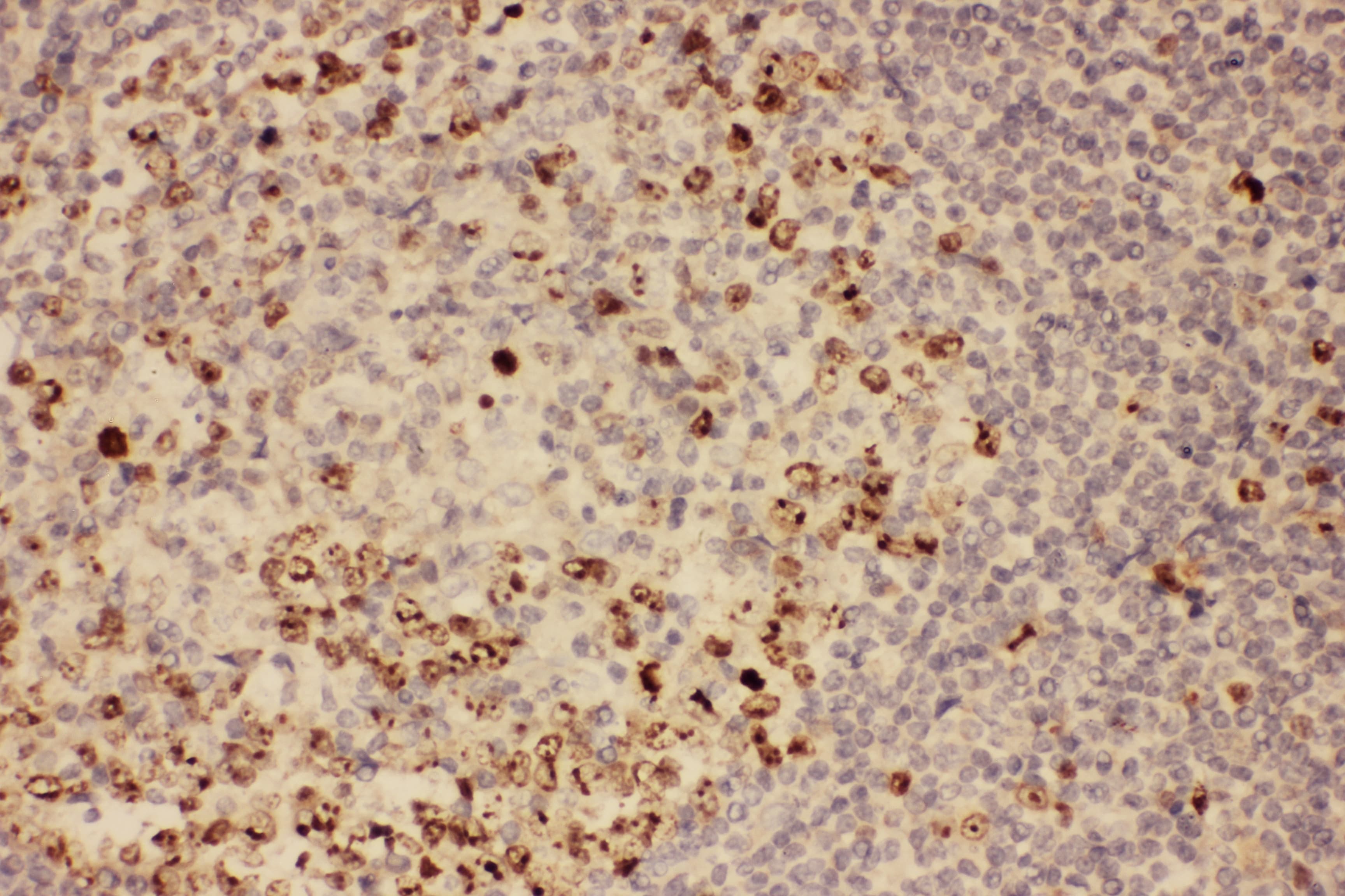 MKI67 / Ki67 Antibody (aa2860-3256)