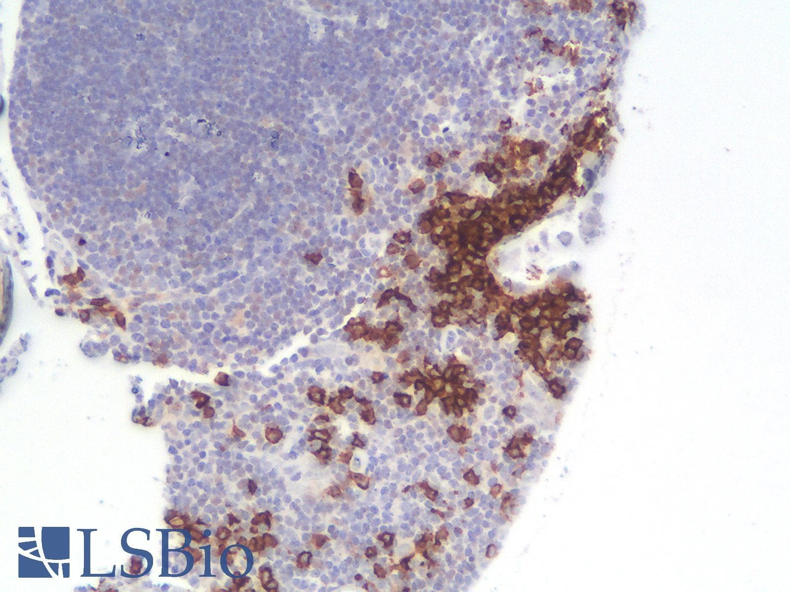 PathPlus™ CD20 Antibody (clone rIGEL/773)