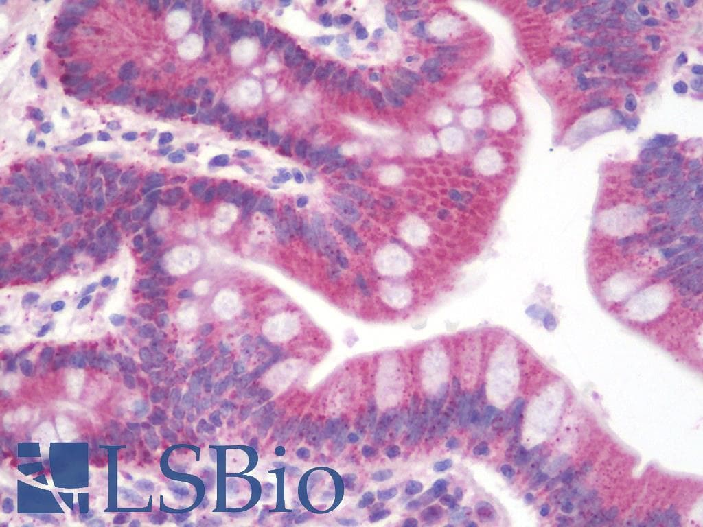 IHC-plus™ PLIN2 / ADFP / Adipophilin Antibody (aa186-214)