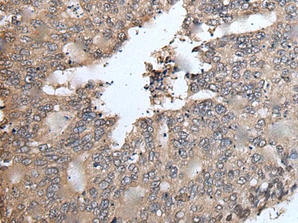 Polyclonal Rabbit anti-Human TRIM23 Antibody (IHC)