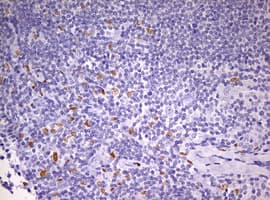 PRX-1 / PRRX1 Antibody (clone OTI2B2)