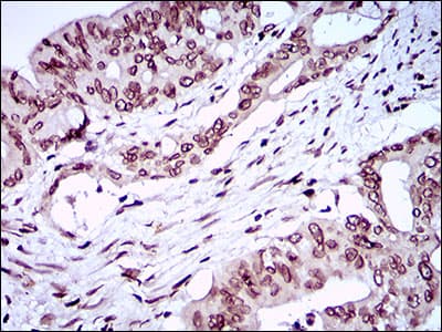 ZEB1 / AREB6 Antibody (aa967-1108, clone 2A8H3)