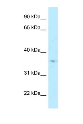 Polyclonal Rabbit anti-Human HSD17B7 / PRAP Antibody (aa160-209, WB)