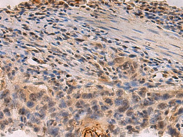 PDS5B / AS3 Antibody