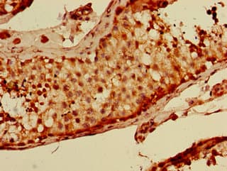 KIAA1811 / BRSK1 Antibody