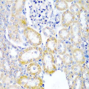 HUPF2 / UPF2 Antibody