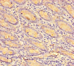 CCL8 / MCP2 Antibody