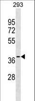 GGPS1 Antibody (aa174-202)