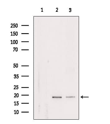 RPL29 / Ribosomal Protein L29 Antibody