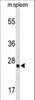 Polyclonal Rabbit anti-Human TPK1 Antibody (aa34-61, IHC, WB)
