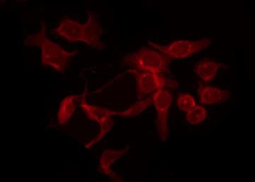 KDR / VEGFR2 / FLK1 Antibody (phospho-Tyr951)